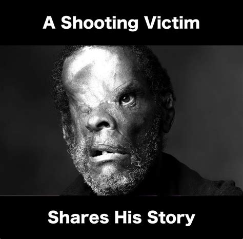 (Photo Credit: @alleyesonmeLA on IG) 49K 664 comments Best Top New Controversial Q&A Add a Comment RustyShackleford98 • 2 yr. . Jerry shooting victim 2006 before and after